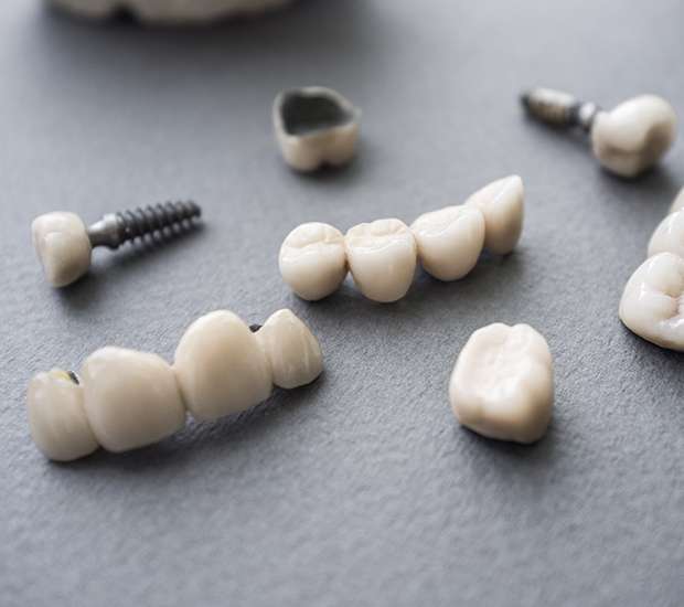 Point Pleasant The Difference Between Dental Implants and Mini Dental Implants